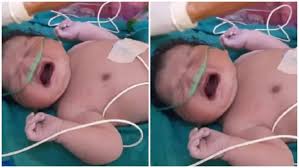 मप्र में जन्मा बाहुबली बच्चा, आप हैरान हो जाएंगे वजन जानकार